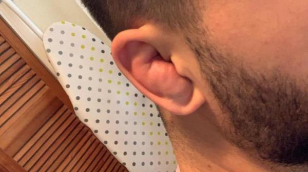 همه چیز راجع به گوش گل کلمی