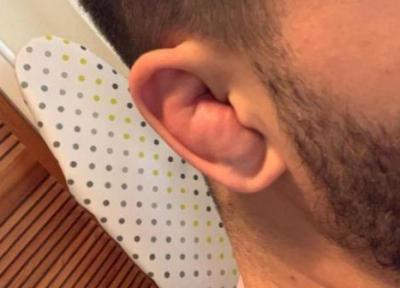 همه چیز راجع به گوش گل کلمی